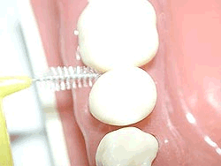 歯間ブラシアニメーション